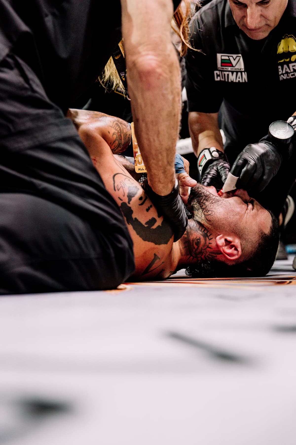 Enzo Tobbia lies on the ground during his bout against Danny Christie