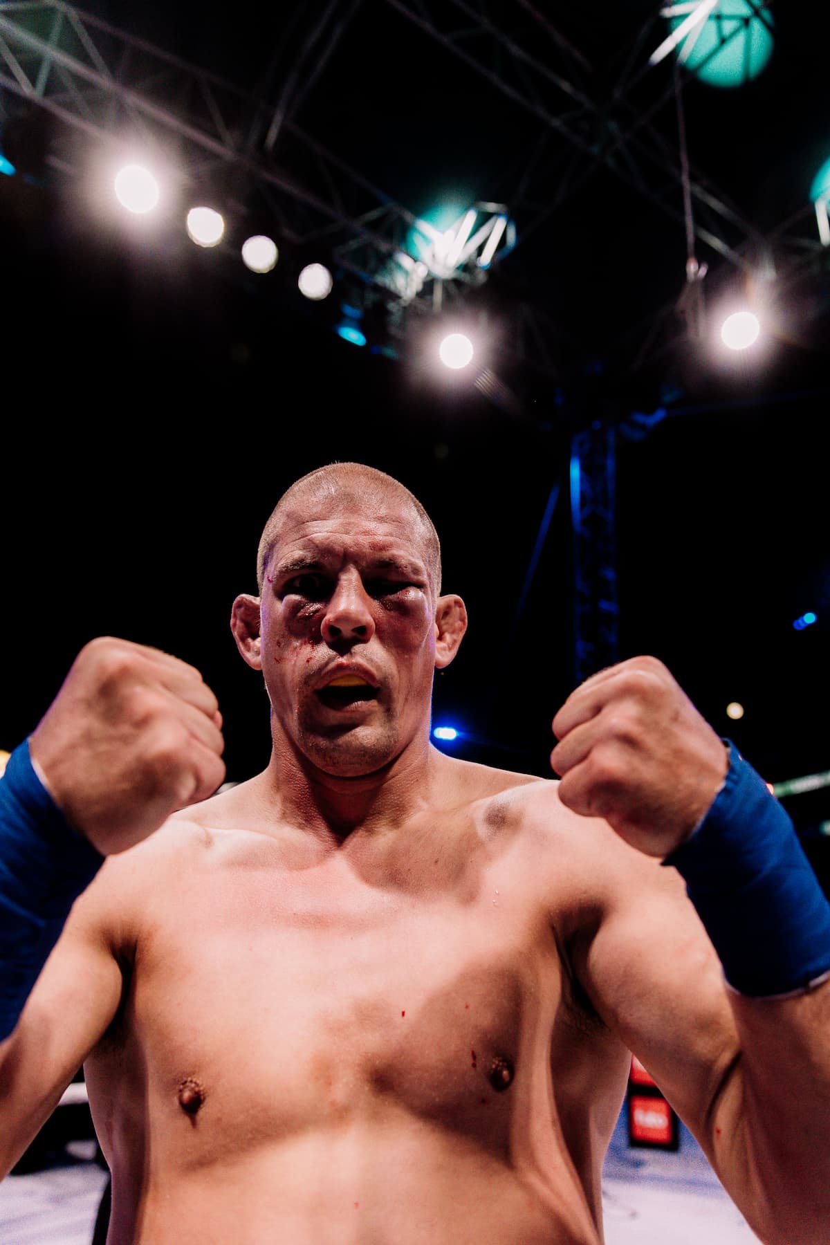Joe Lauzon poses after his victory over Stash Kuykendall